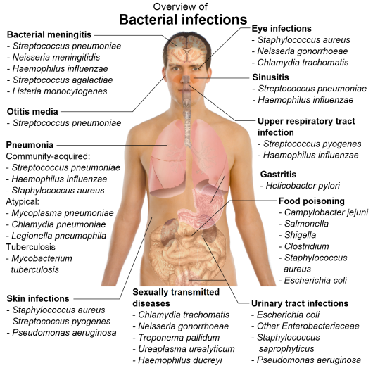 Bacterial Infections