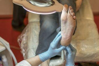 diabetic foot examination