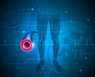 arterial and vascular disease