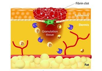 wound healing